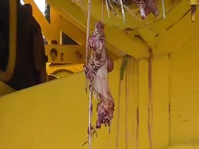 Kid Loses Foot in Harvester Accident (Better Quality)