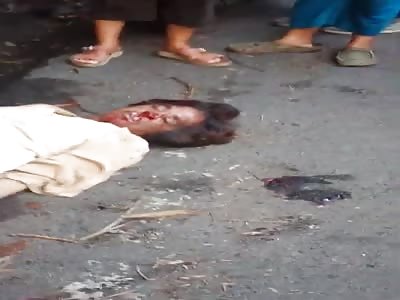 Womans Body Laid out in the Street