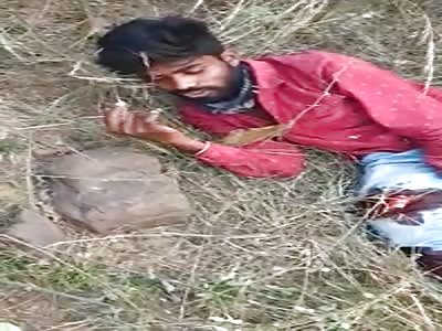 Bikers Leg Bone Poking Out