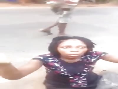 Mans Leg Fucked from Accident