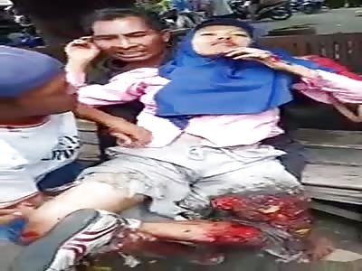 Woman Gets Her Leg Shredded in Harvester Accident