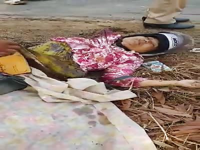 Young Woman Died with the Legs Shredded - Friend Ripped in Half