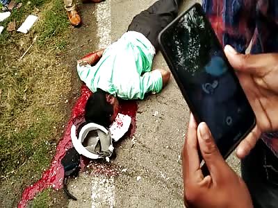 Helmet didn't Help Much