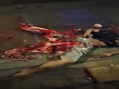 Biker Got Turned into Unrecognizable Mess