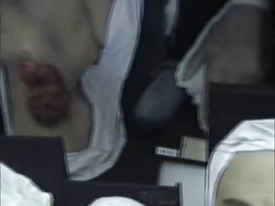 Museo di Anatomia Patologica 