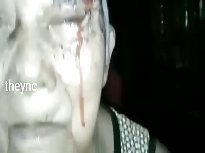 Infection in the face