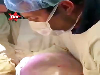 great cancer tumor wtf