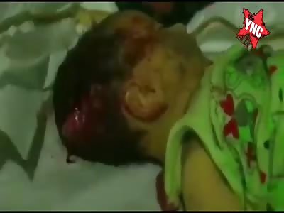  babies killed by headshot