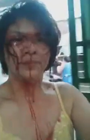 Coward Beats Ex-Girlfriend Bloody