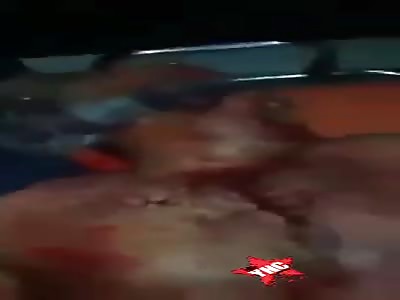 Seriously injured man