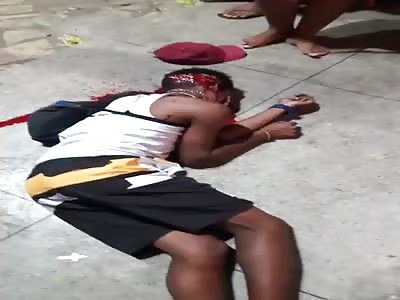 Young man shot to the head