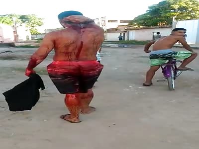 by drug addict,  with machete wound