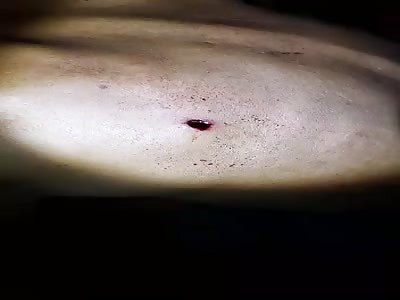 Man in agony received multiple shots from firearm