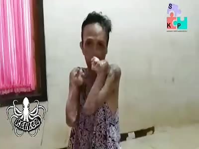 Wtf, victim of terrible accident with boiling water boiler