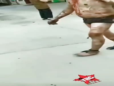 wtf, man walking with burns on his body
