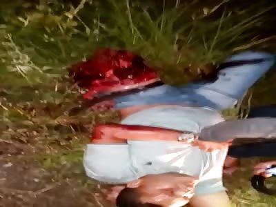 Homeboys Leg Ripped Right the Fuck Off