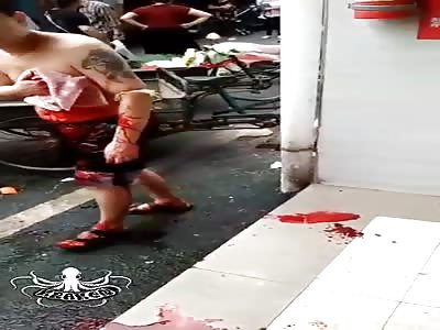 the man was attacked with a knife