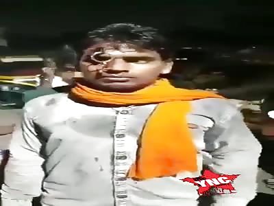 LOL: Keys Buried in the Forehead