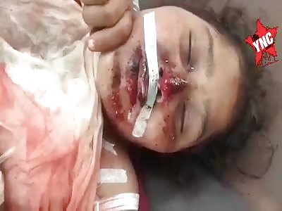 Aftermath, the woman was brutally beaten by her husband