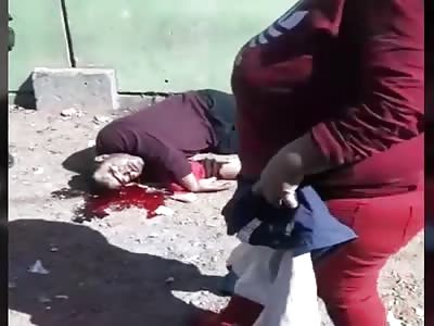 man shot in the head