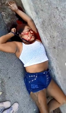 Close-Up Footage Of A Woman Killed By Faction