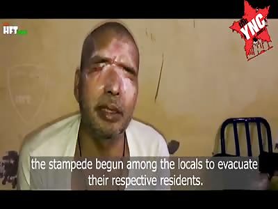 aftermath, after being sprayed with acid on his face