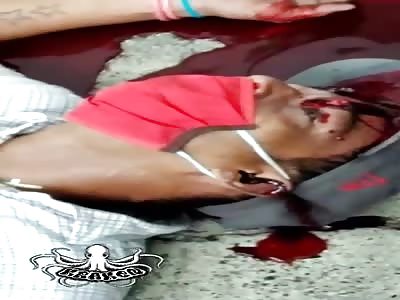 Colombia, man shot in the head