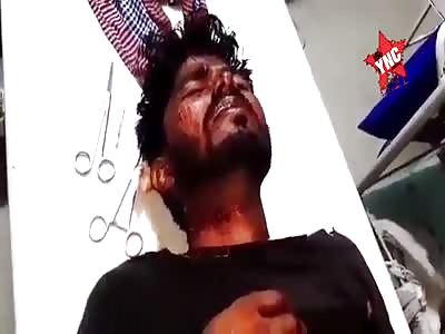 Neck wound after being mugged.