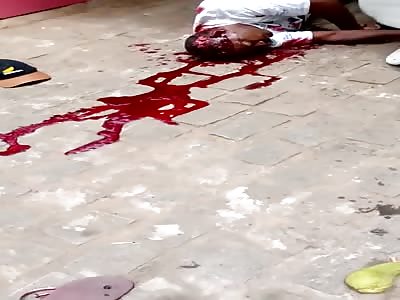 Man shot in the head