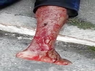 Man shot in the legs