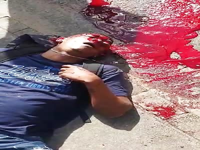 Man shot in the head