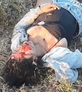 Prime Example of Why Helmets Are Important