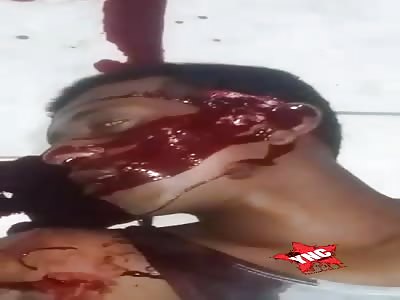 Young people were shot to death