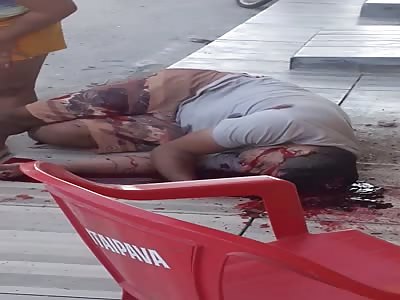 Man shot in the head