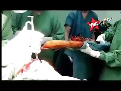 Ouch, friend you shouldn't have left the house