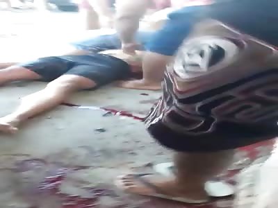 man shot in the head