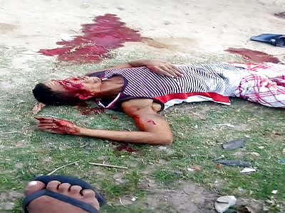 Man in his last moments of life