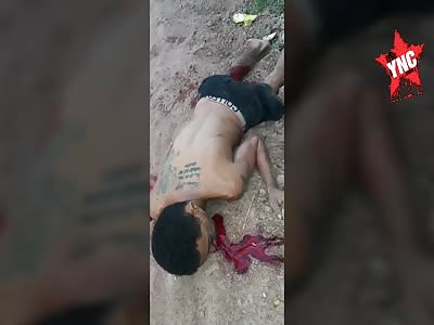 Man shot in the head