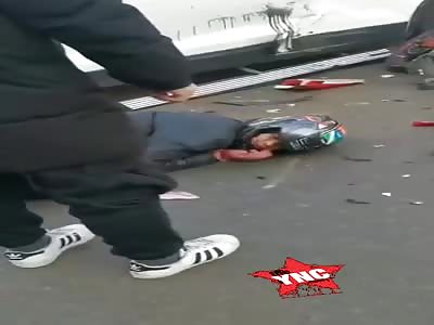 Agony after motorcycle accident