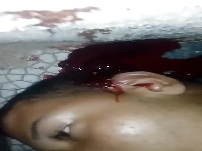 Man shot in the head