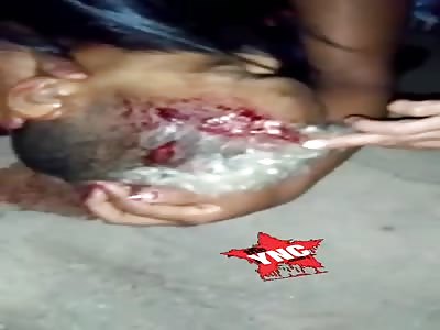 Young man was shot in the head