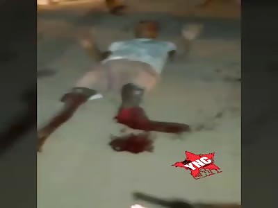  Friend that must hurt