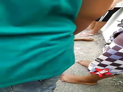 man shot in the head