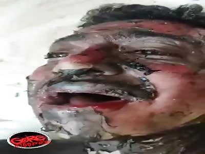 The man was burned alive