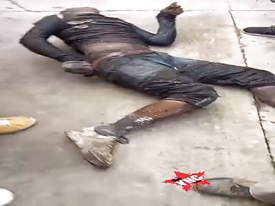 Young man burned alive