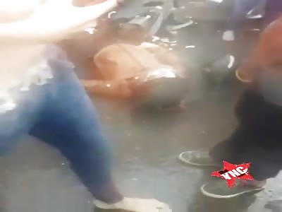 Young man shot in the head