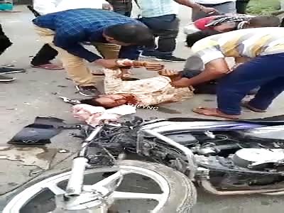 Cyclist was seriously injured.