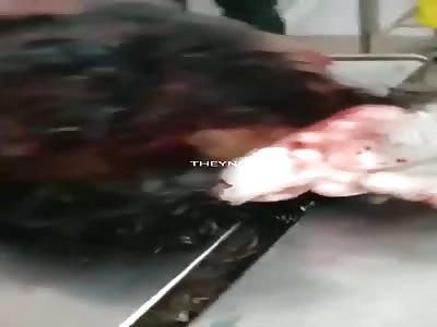 Man killed with machetes