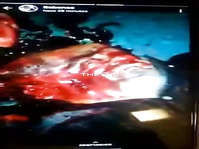 Another video of the assassinated hitmen