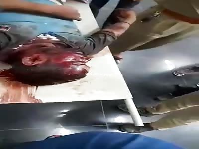 Dude, fucked up by the ears